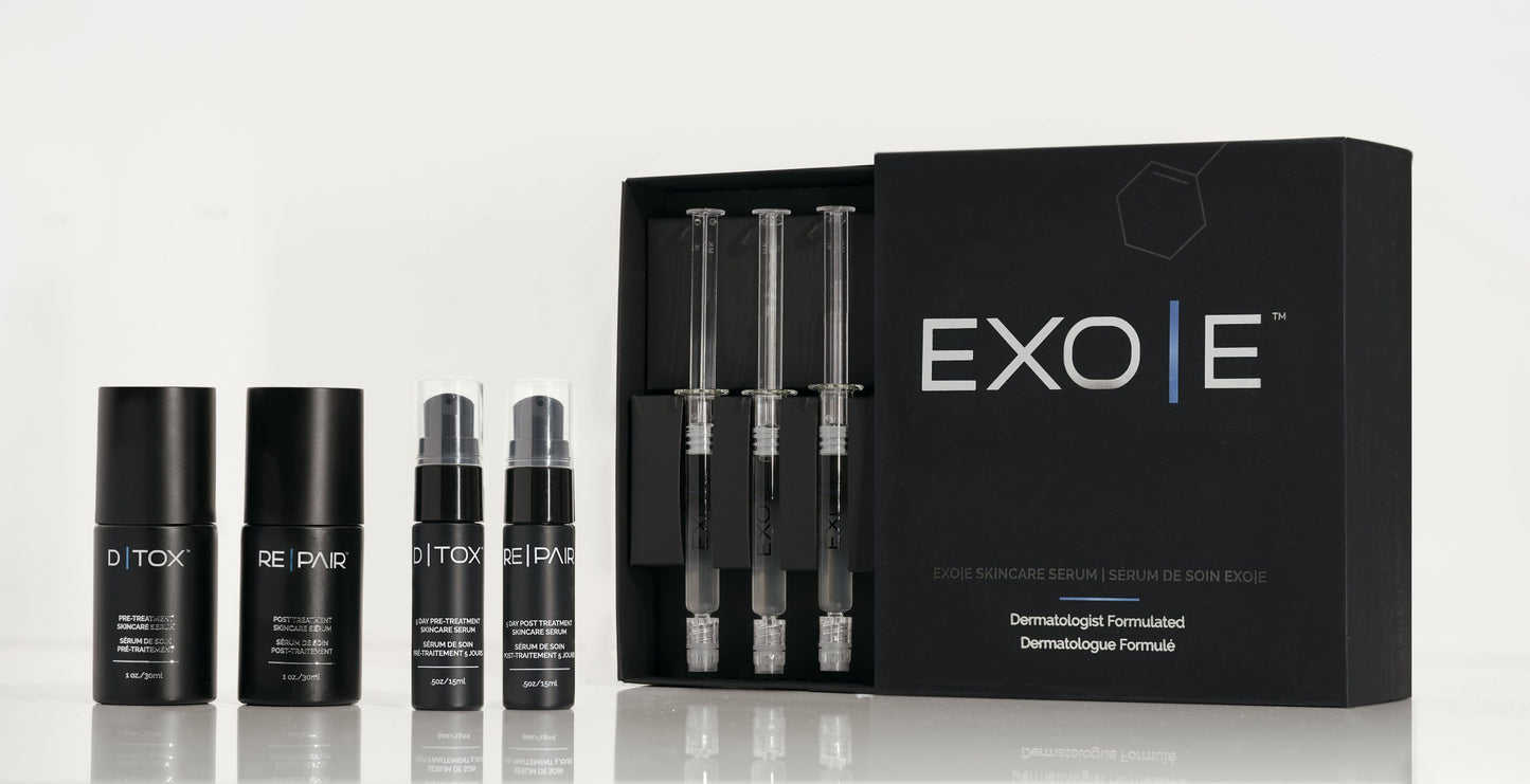 Exo/E Add On