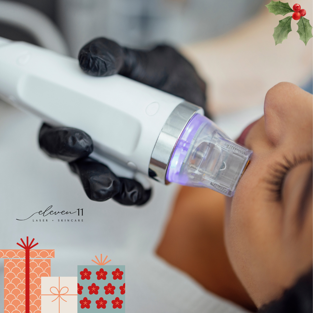 š Christmas Glow: RF Microneedling Special 50% OFF! š