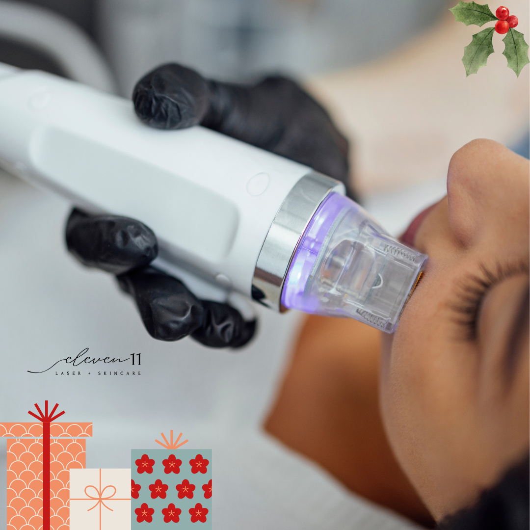 🎄 Christmas Glow: RF Microneedling Special 50% OFF! 🎄