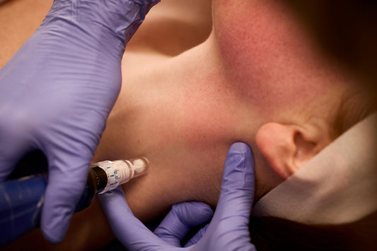Microneedling Neck Add On