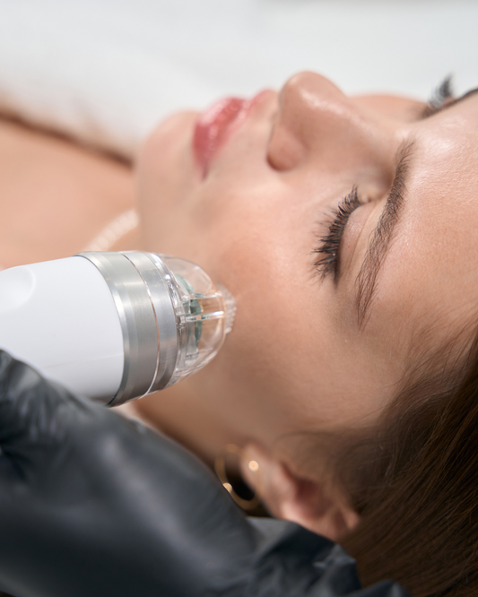 Radio Frequency Microneedling