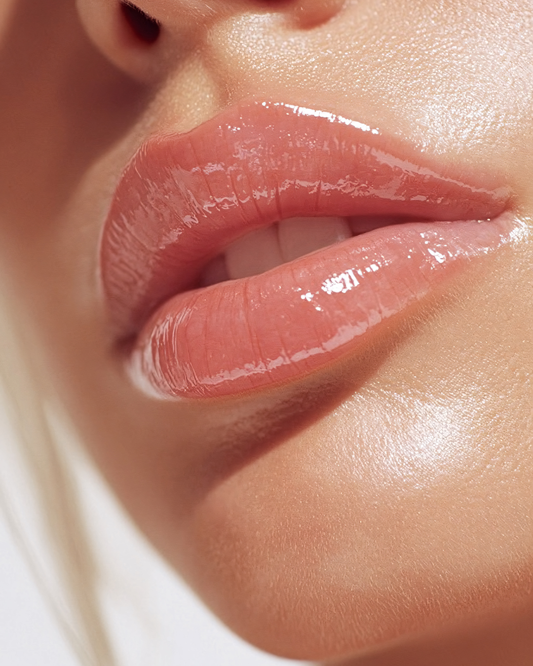 Lip Filler