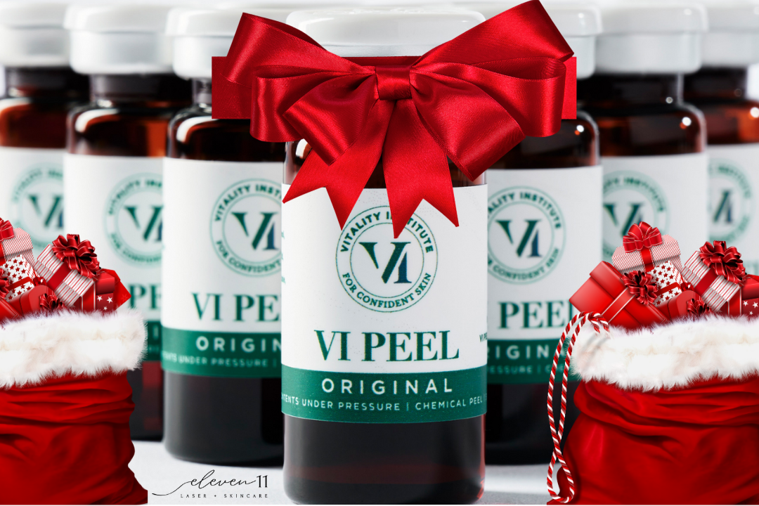 Day 8 🎄 Holiday Glow: BOGO 1/2 Off VI Original Chemical Peels! ✨